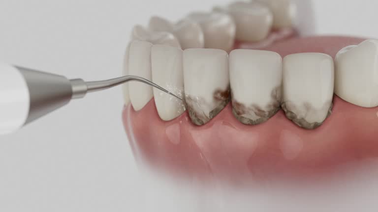 Trusted Tooth Extraction service in Holly Hill, SC - Dentist Open Now